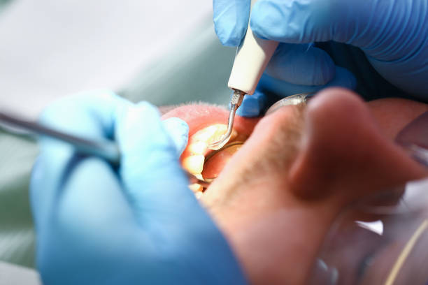 Best 24-Hour Emergency Dental Care in Bacliff, TX