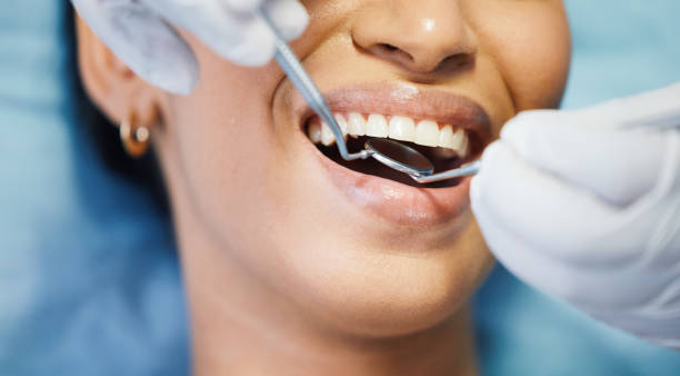 Best Emergency Care for Gum Disease in Bacliff, TX
