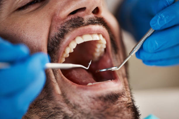 Best Walk-In Emergency Dental Services in Bacliff, TX
