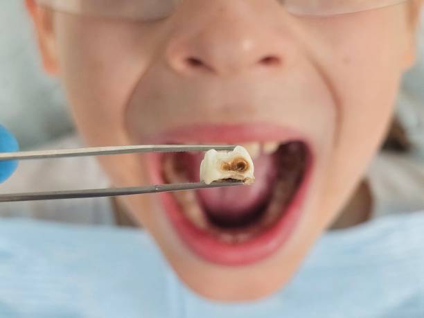 Best Emergency Treatment for Jaw Pain or Injury in Bacliff, TX